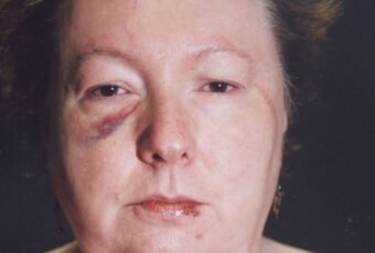 Susan Kuhnhausen Killed the Hitman Her Ex-Husband Sent to Kill Her