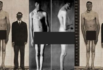 Adam Rainer: The Only Man to be Both a Dwarf and a Giant